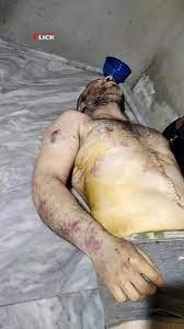 "الجندرما" التركية تعذب مواطن سوري وترميه جثة هامدة