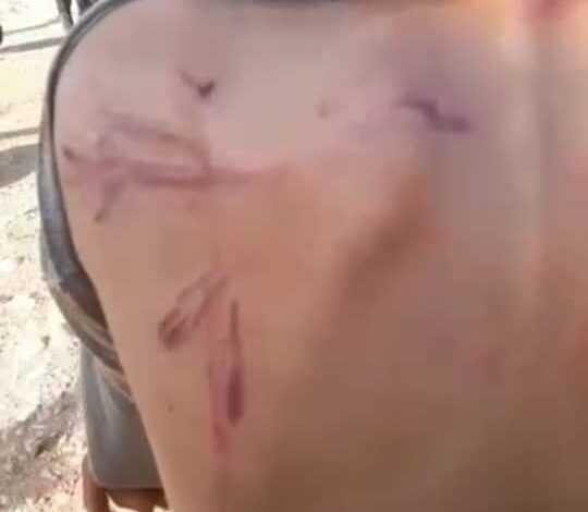 "النصرة" تعاقب طفلاً بالجلد بسبب تهريب الدخان بريف إدلب