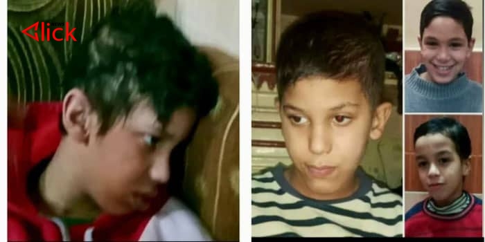 علاجه غير متوفر في سورية.. مرض نادر يصيب 3 أطفال من عائلة واحدة بريف دمشق